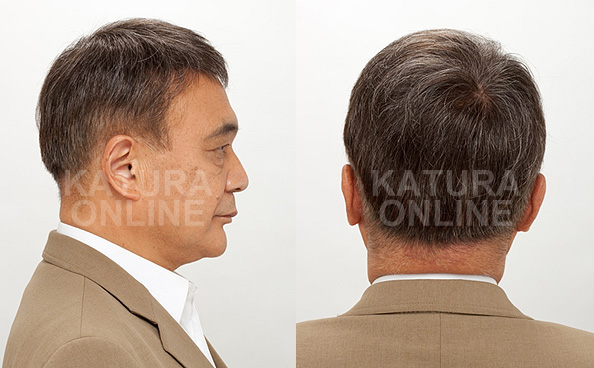 mounting_img_06 mounting_img_06