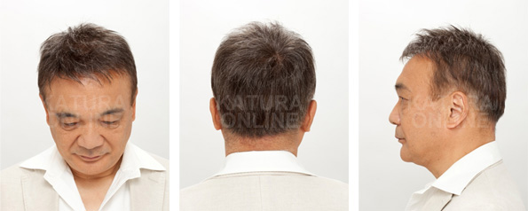 mounting_img_08 mounting_img_08