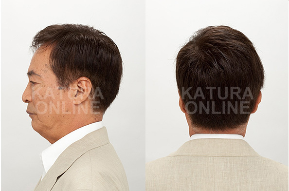 mounting_img_10 mounting_img_10