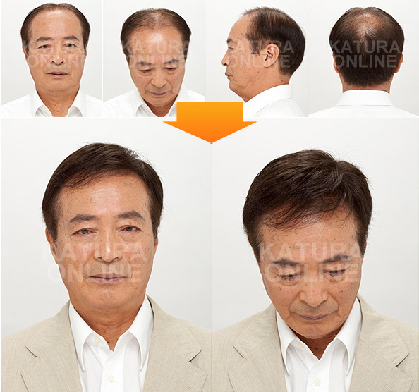 かつらの使用前、使用後(60代) mounting_img_9