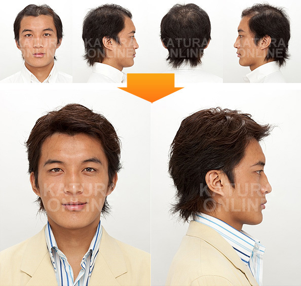 部分かつらの使用前、使用後(20代) mounting_img_01