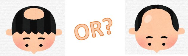 脱毛範囲に応じたかつらの大きさ 脱毛範囲に応じたかつらの大きさ