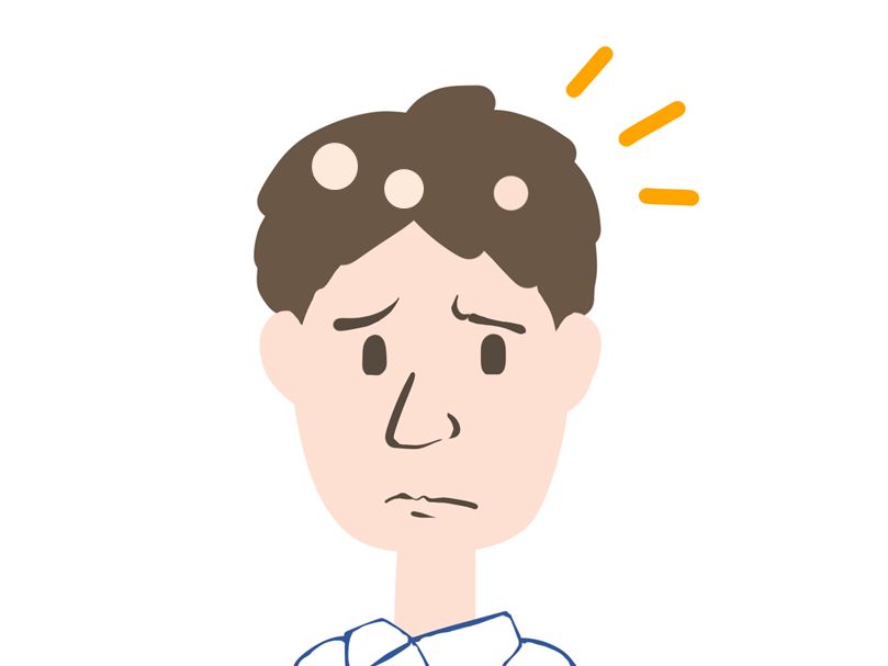 かつらのピンで自毛に脱毛が起こる? かつらのピンで自毛に脱毛が起こる?