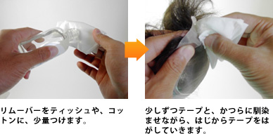 リムーバーをティッシュや、コットンに、少量つけます。少しずつテープと、かつらに馴染ませながら、はじからテープをはがしていきます。 リムーバーをティッシュや、コットンに、少量つけます。少しずつテープと、かつらに馴染ませながら、はじからテープをはがしていきます。