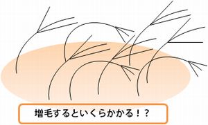 増毛の費用について 増毛の費用について