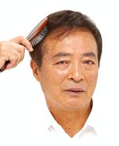 かつら装着後 かつら装着後