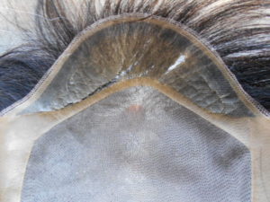 かつらベースの痛み かつらのベースの痛み