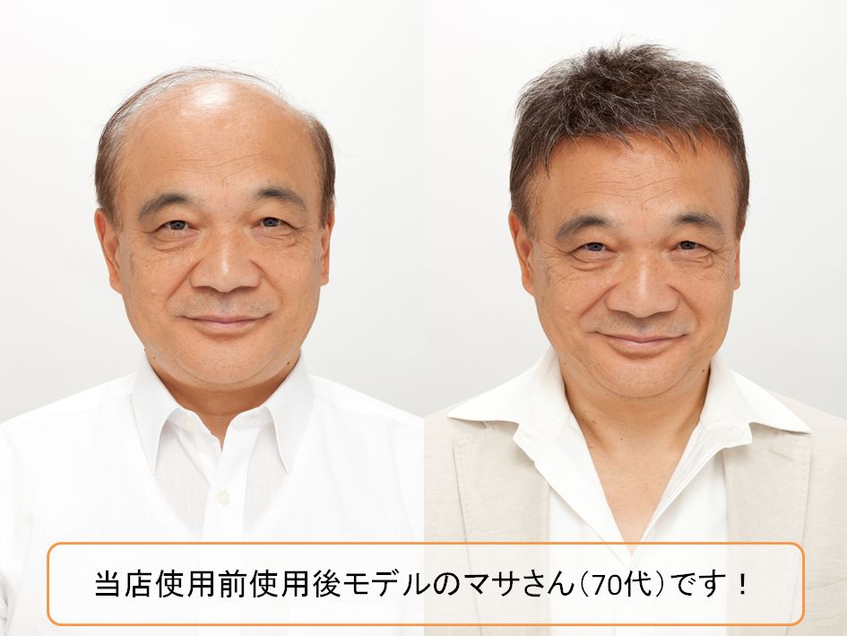 かつら使用前・使用後