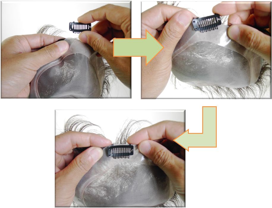 かつらに移動ピンを装着 かつらに移動ピンを装着