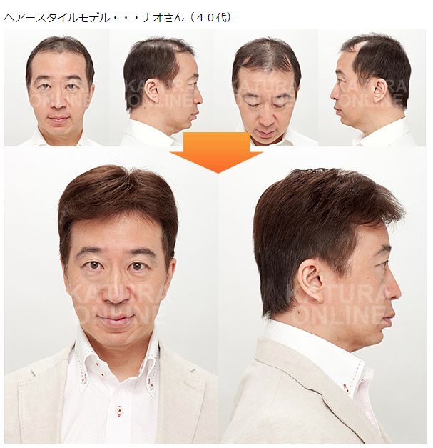 かつらの使用前・使用後 かつらの使用前・使用後