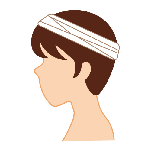 植毛手術後 植毛手術後