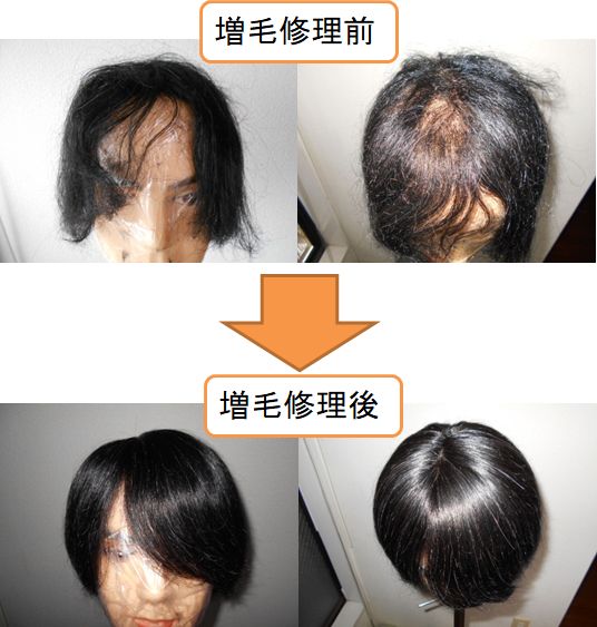 増毛修理前・修理後 増毛修理前・修理後