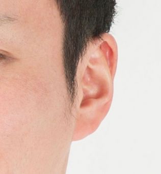 もみあげから頬骨の辺り もみあげから頬骨の辺り