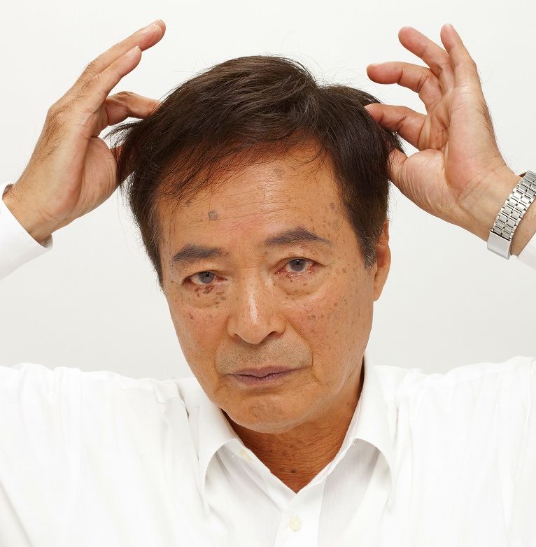 かつらの装着位置 かつらの装着位置