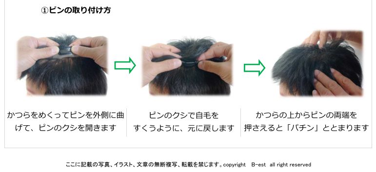 かつらピン装着の仕方 かつらピン装着の仕方