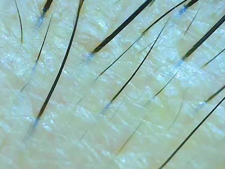 頭皮の拡大写真 頭皮の拡大写真