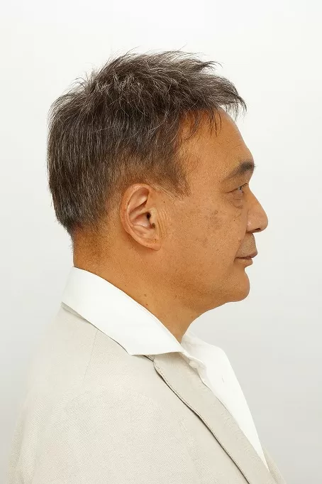 かつらの使用後 かつらの使用後